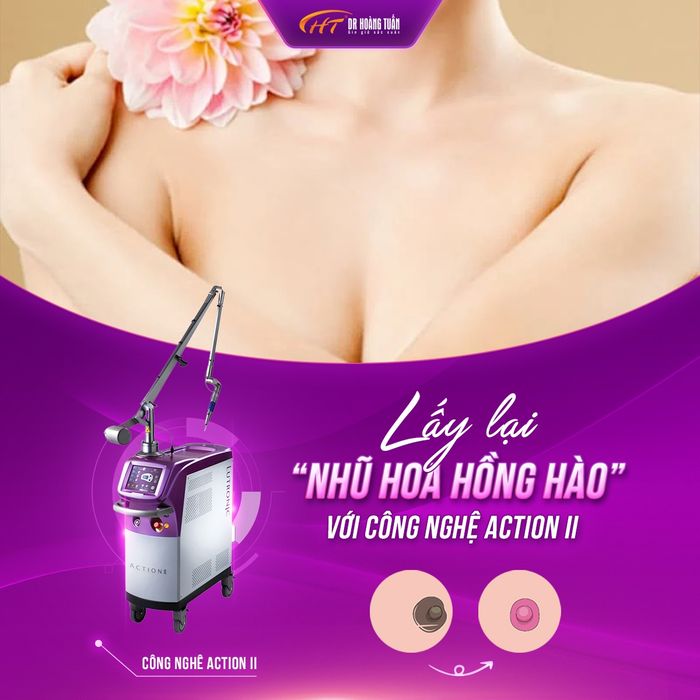 Hình ảnh quy trình làm hồng nhũ hoa bằng Laser Action II
