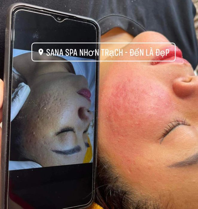 Hình ảnh thứ hai về Sana Nhơn Trạch - Minh chứng cho quy trình chăm sóc da chuyên nghiệp với hệ thống máy móc tân tiến và đội ngũ kỹ thuật viên lành nghề
