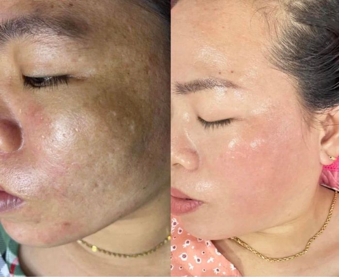 Trải nghiệm dịch vụ cao cấp tại Hồng Hạnh Spa - Ảnh 2