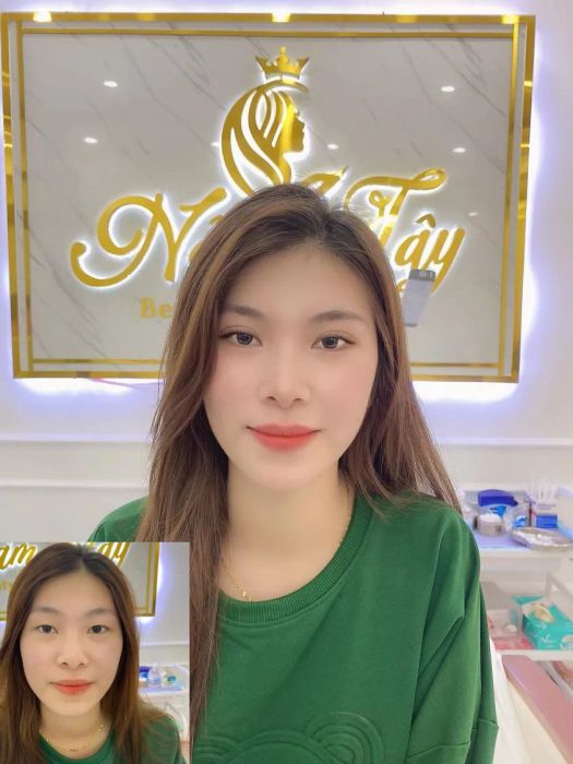 Hình ảnh Nấm Tây Clinic