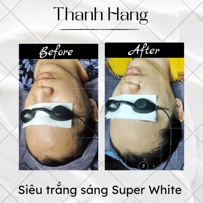 Hình ảnh thứ hai về Thanh Hằng Spa - Cosmetic: Không gian trị liệu sang trọng với đầy đủ trang thiết bị hiện đại, nơi mỗi khách hàng đều được trải nghiệm dịch vụ chăm sóc da chuyên nghiệp nhất