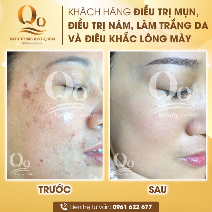 Trải nghiệm dịch vụ cao cấp tại Thẩm mỹ viện Thanh Quỳnh