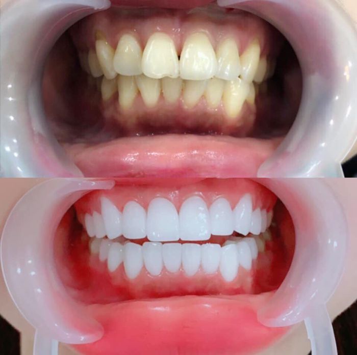 NHA KHOA QUỐC TẾ - Hình ảnh 1