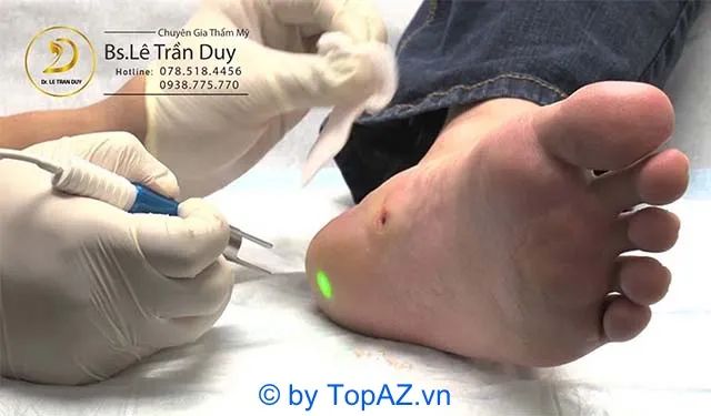 Địa chỉ đốt mụn cóc uy tín nhất TP.HCM