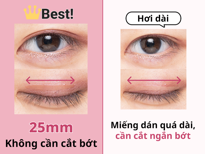 Hình ảnh thực tế minh họa cách dán mí (Nguồn: Internet)