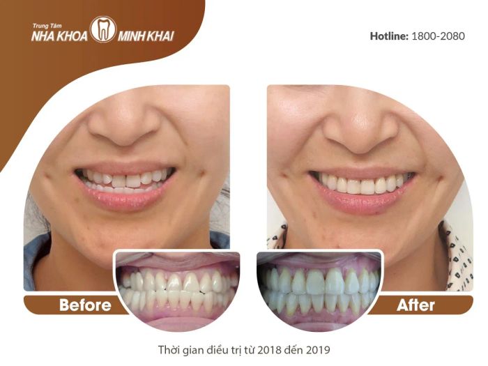 Hình ảnh cơ sở vật chất hiện đại tại Nha khoa Minh Khai