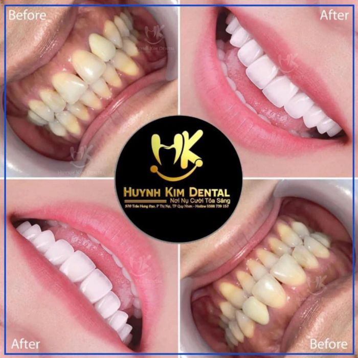 Nha Khoa Thẩm Mỹ Quy Nhơn - Huỳnh Kim Dental ảnh 2