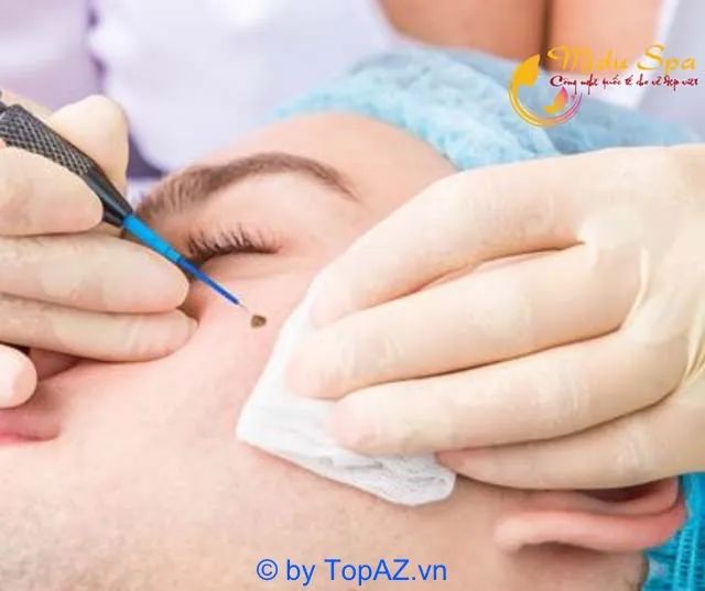 Địa chỉ trị mụn cóc uy tín bậc nhất tại TP.HCM