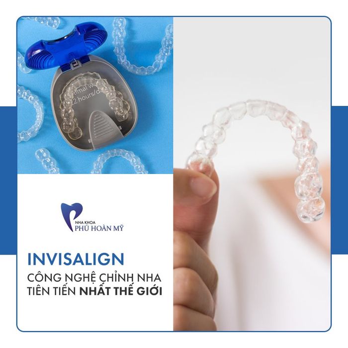 INVISALIGN - công nghệ chỉnh nha hiện đại bậc nhất thế giới, được Nha Khoa Phú Hoàn Mỹ áp dụng trong kỹ thuật niềng răng để mang lại hiệu quả tối ưu.