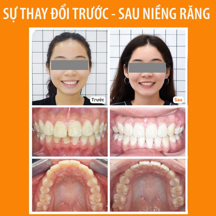 Không gian hiện đại tại Up Dental - Trung tâm niềng răng chuyên sâu