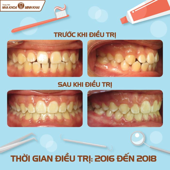 Hình ảnh đội ngũ bác sĩ chuyên môn tại Nha khoa Minh Khai