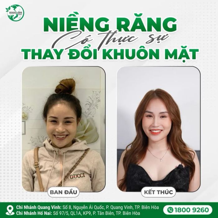 Hình ảnh thực tế Nha Khoa Khắc Ghi