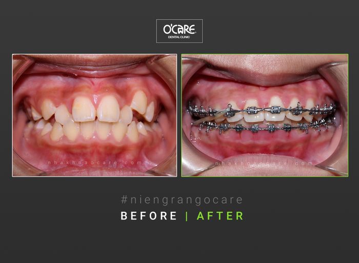 Hình ảnh phòng khám hiện đại đạt chuẩn quốc tế tại Nha khoa O'CARE