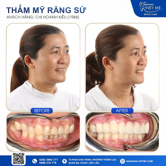 Hình ảnh phòng điều trị tiêu chuẩn tại Nha Khoa Việt Mỹ