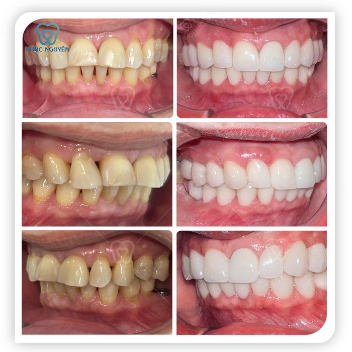 Hình ảnh phòng điều trị tiêu chuẩn tại Nha khoa Phúc Nguyên