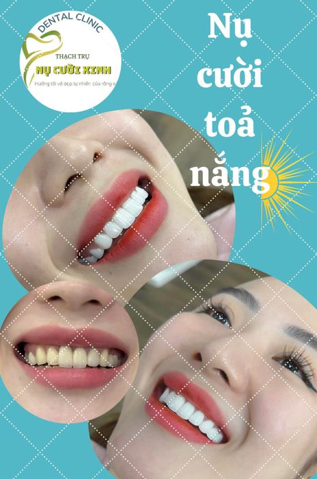 Hình ảnh thực tế Nha Khoa Thạch Trụ - không gian hiện đại, tiện nghi
