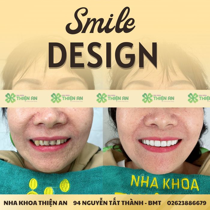 Hình ảnh thực tế Nha Khoa Thiện An - không gian sang trọng, chuyên nghiệp