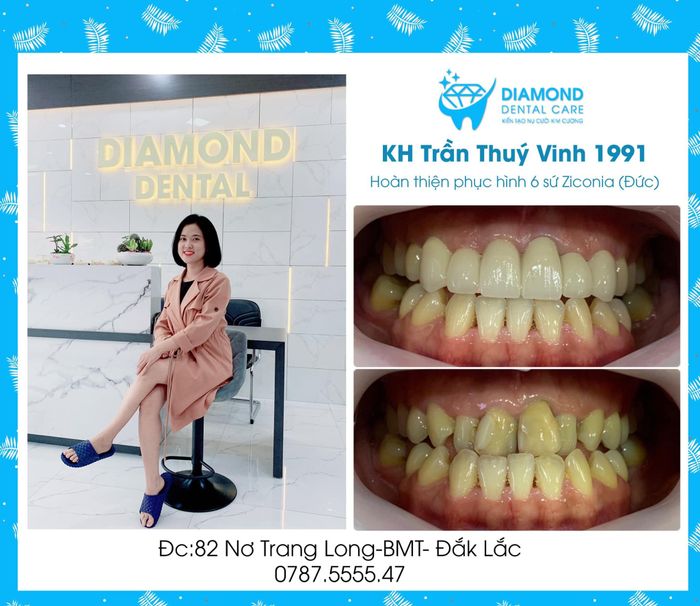 Hình ảnh thực tế Nha Khoa Diamond Kim Cương - không gian sang trọng, hiện đại