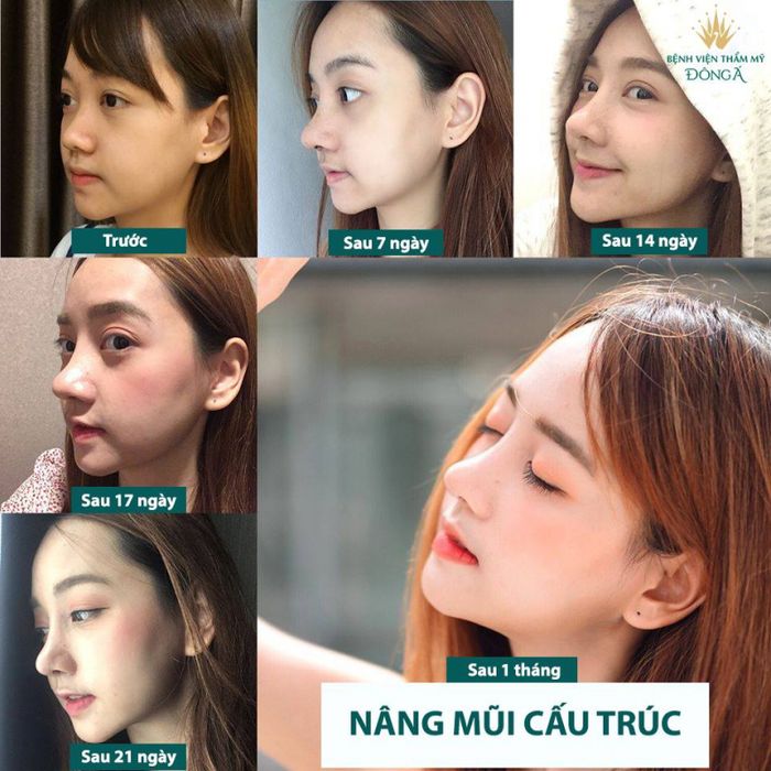 Hệ thống phòng phẫu thuật hiện đại tại Bệnh viện Đông Á