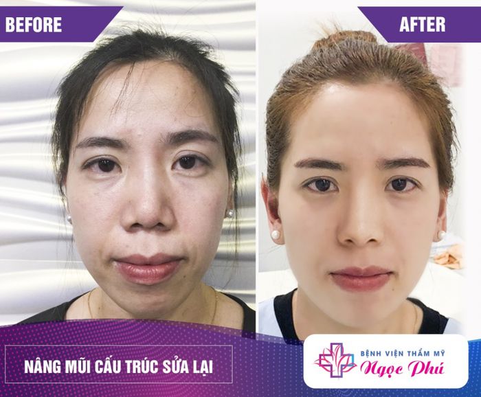 Hệ thống phòng phẫu thuật đạt chuẩn quốc tế tại Bệnh viện Thẩm mỹ Ngọc Phú
