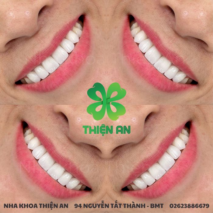 Hình ảnh thực tế Nha Khoa Thiện An - cơ sở vật chất hiện đại