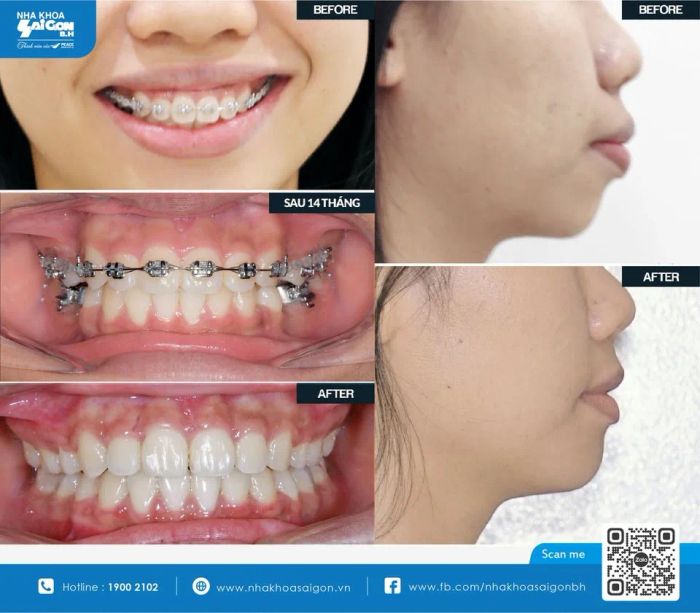 Hình ảnh thực tế Nha Khoa Sài Gòn B.H - Chi nhánh Hố Nai
