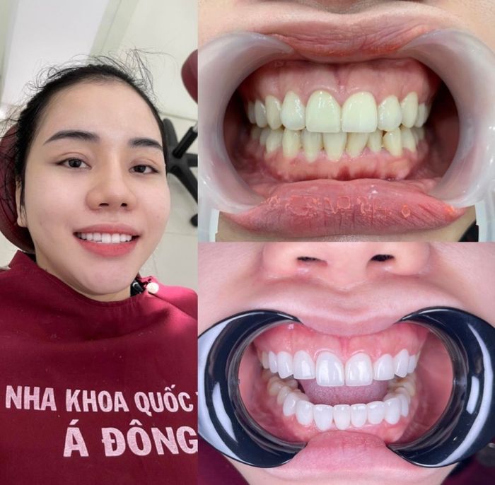 Hình ảnh phòng điều trị hiện đại tại Nha Khoa Quốc Tế Á Đông