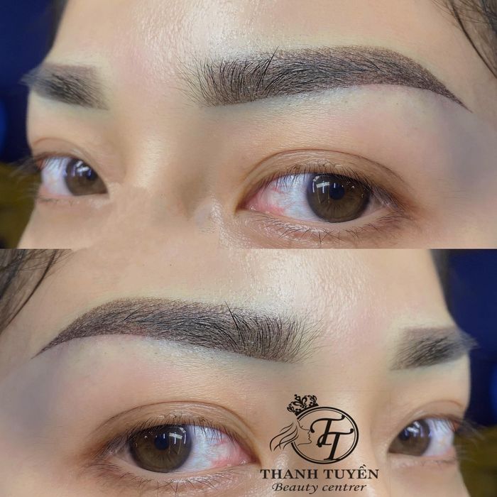 Hình ảnh thực tế dịch vụ tại Thanh Tuyền Beauty