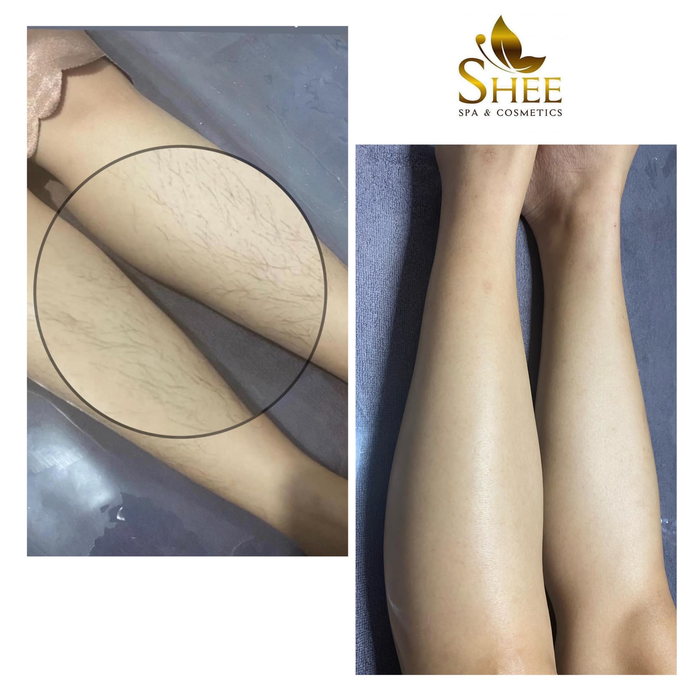 Hình ảnh hệ thống máy móc hiện đại tại Shee Spa