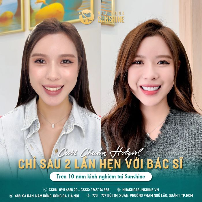 Hình ảnh Nha khoa thẩm mỹ Sunshine (1)