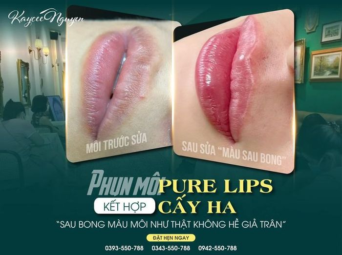 Thẩm Mỹ Kaycee Nguyen - Khoảnh khắc tỏa sáng cùng nét đẹp hoàn mỹ
