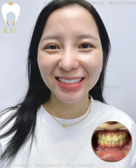 Hình ảnh Nha Khoa Quốc Tế Kay (1)