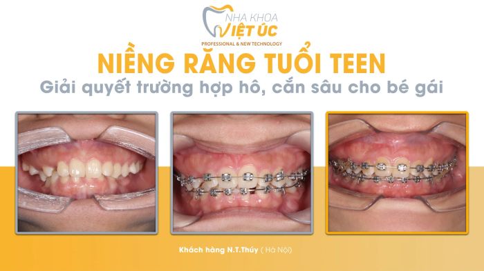 Hình ảnh NHA KHOA VIỆT ÚC (2)