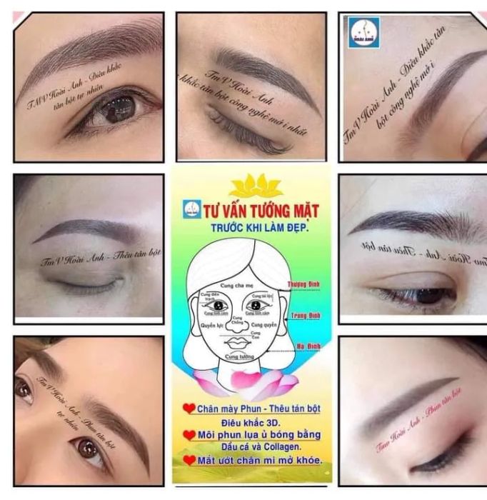 Bộ sưu tập thành tựu 20 năm của Thẩm mỹ viện Hoài Anh