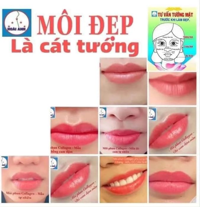 Không gian sang trọng đạt chuẩn 5 sao tại Thẩm mỹ viện Hoài Anh
