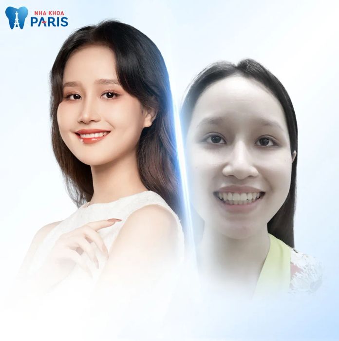 Hình ảnh Nha khoa Paris