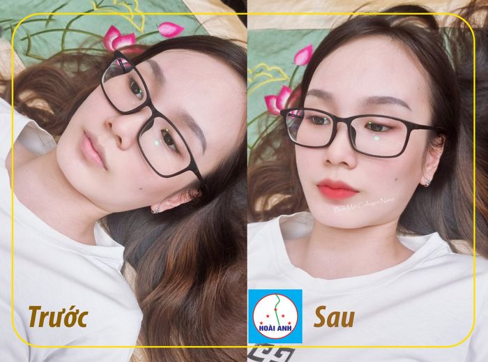 Hình ảnh ấn tượng tại Thẩm mỹ viện Hoài Anh