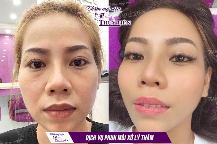 Kết quả phun môi ấn tượng tại Thẩm Mỹ Viện Thủy Tiên