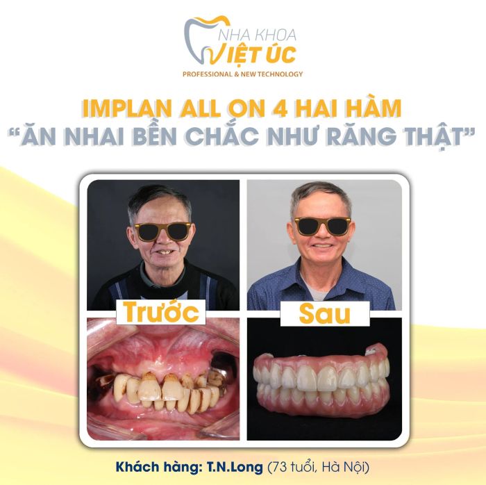 Hình ảnh Nha Khoa Việt Úc