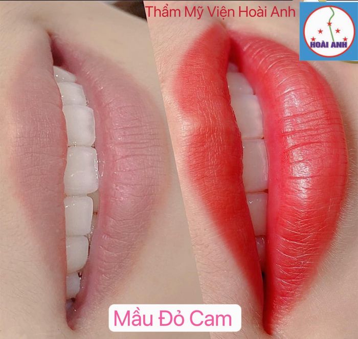 Không gian thư giãn đẳng cấp tại Thẩm Mỹ Viện Hoài Anh