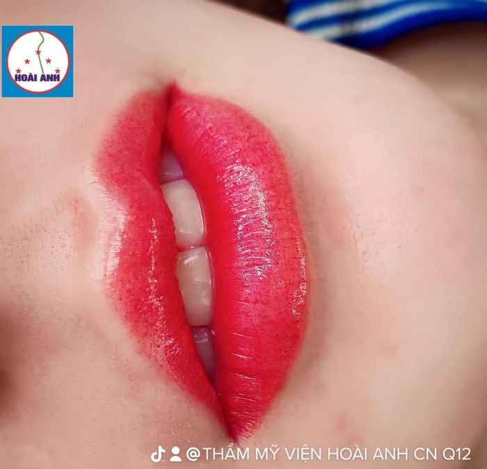 Không gian sang trọng tại Thẩm Mỹ Viện Hoài Anh