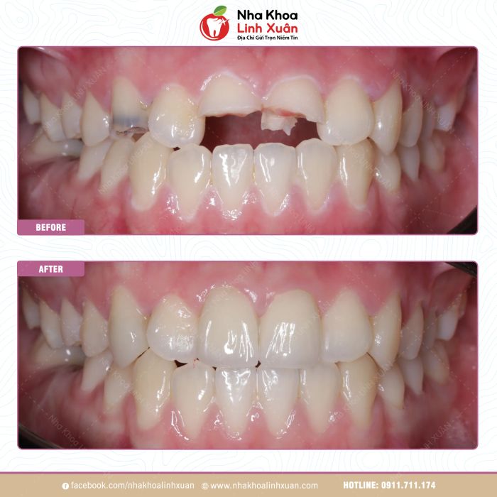 Hình ảnh phòng khám Nha Khoa LINH XUÂN - Trang thiết bị tân tiến