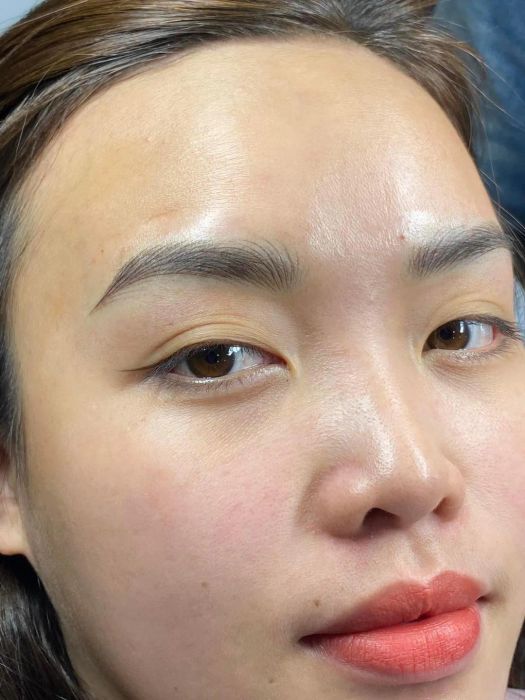Hình ảnh thực tế dịch vụ tại Viện thẩm mỹ Bảo Xinh