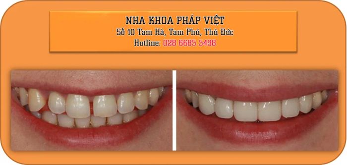 Hình ảnh Nha Khoa Pháp Việt - Không gian sang trọng đạt chuẩn Pháp