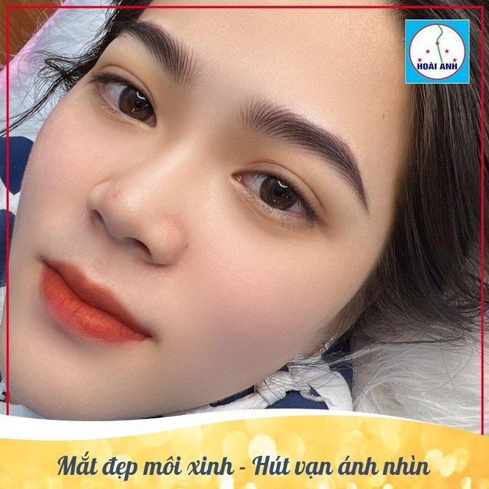 Khám phá Thẩm Mỹ Viện Hoài Anh qua hình ảnh ấn tượng - nơi kiến tạo nét đẹp hoàn mỹ