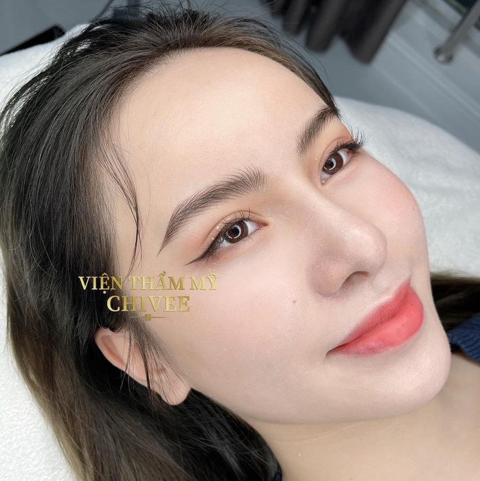 Khám phá Viện Thẩm Mỹ ChiVee qua hình ảnh thực tế - nơi gửi trọn niềm tin làm đẹp