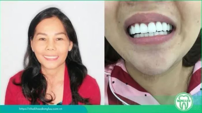 Hình ảnh phòng Labo Nha Khoa Đăng Lưu - Công nghệ sản xuất răng sứ tiên tiến