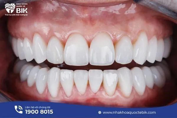 Hình ảnh Nha Khoa Quốc Tế BIK - Không gian hiện đại đạt chuẩn quốc tế