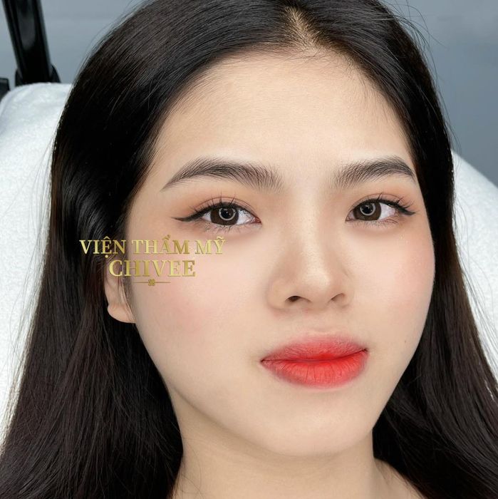 Bộ sưu tập hình ảnh đẳng cấp tại Viện Thẩm Mỹ ChiVe - minh chứng cho sự hoàn hảo