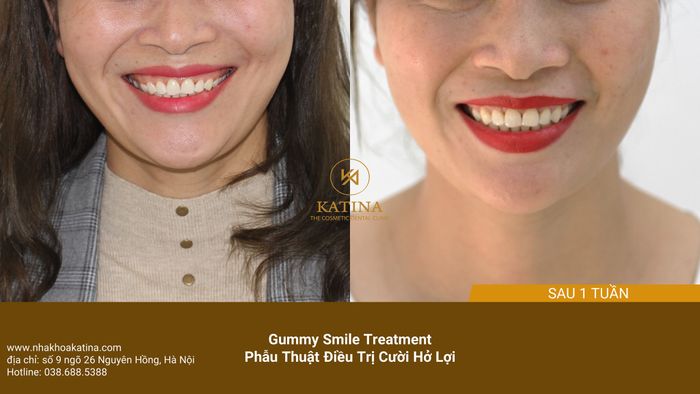 Hình ảnh thực tế về không gian hiện đại tại Nha Khoa Katina